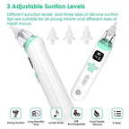 Baby Electronic Nasal Aspirator - Safe, Fast, Hygienic Snot Sucker for Newborn & Toddler