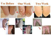 Image of Babies Feet Original Deep Moisturizing Exfoliation for Feet Peel Socks (1 Pair Set) - Balma Home